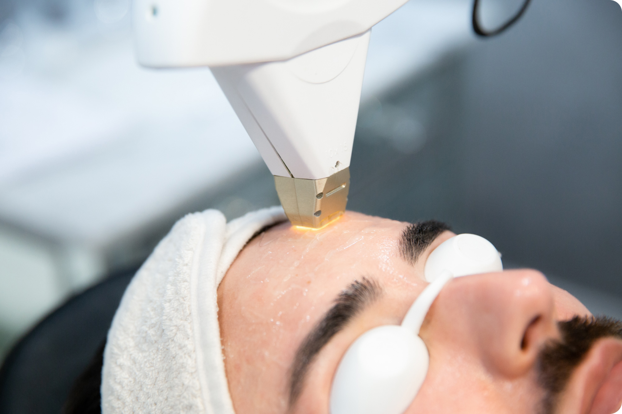 A close up of a person getting IPL, one of the available light facials in Austin.