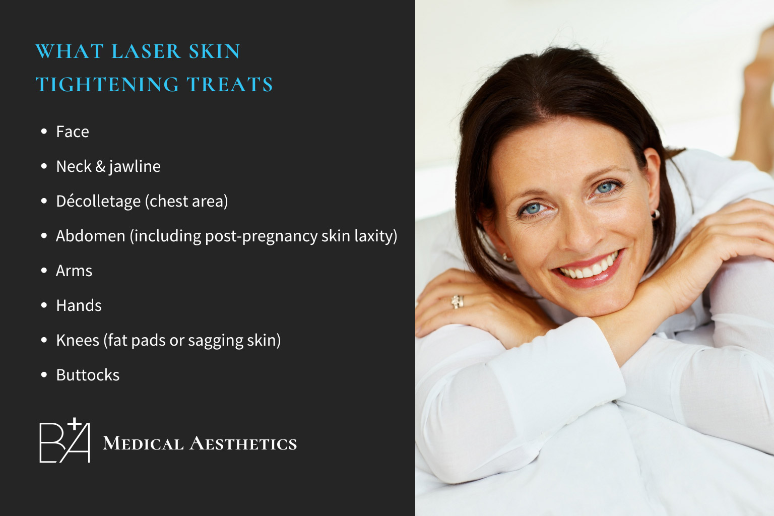 The Power of Biostimulators: Radiesse & Sculptra for Skin Tightening