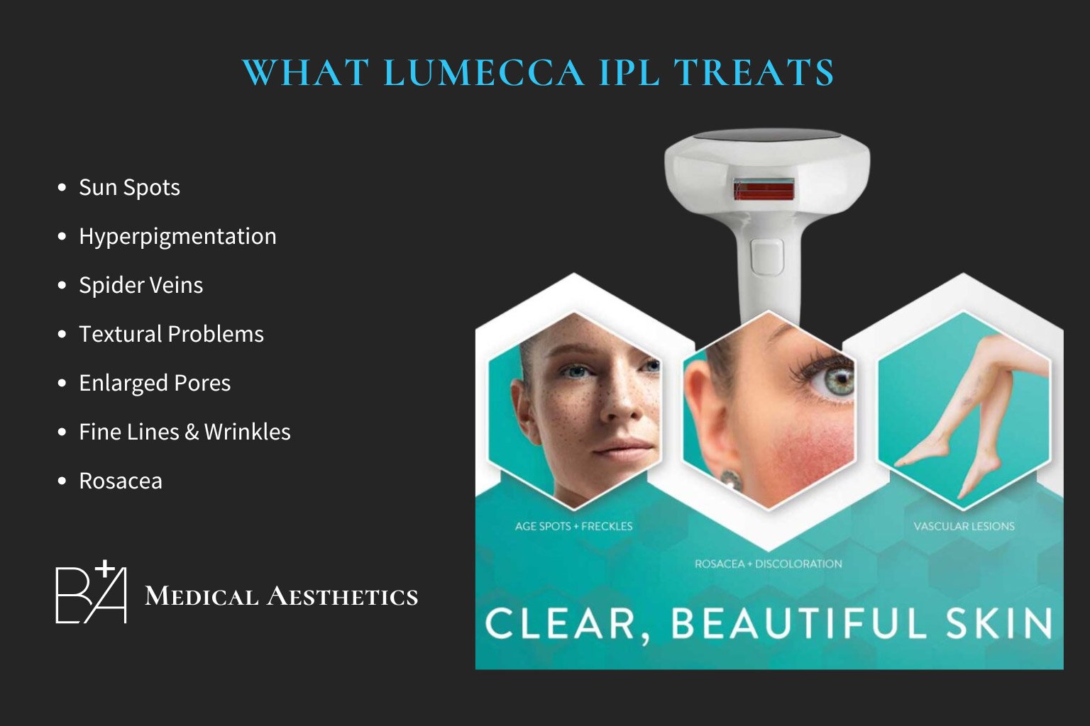 Lumecca IPL: Target Pigment, Boost Radiance, Tighten Skin