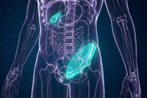 3 Common General Surgeries: Gallbladder, Hernia & Lipomas