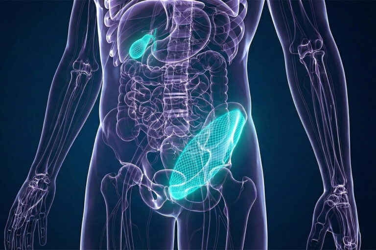 3 Common General Surgeries: Gallbladder, Hernia & Lipomas