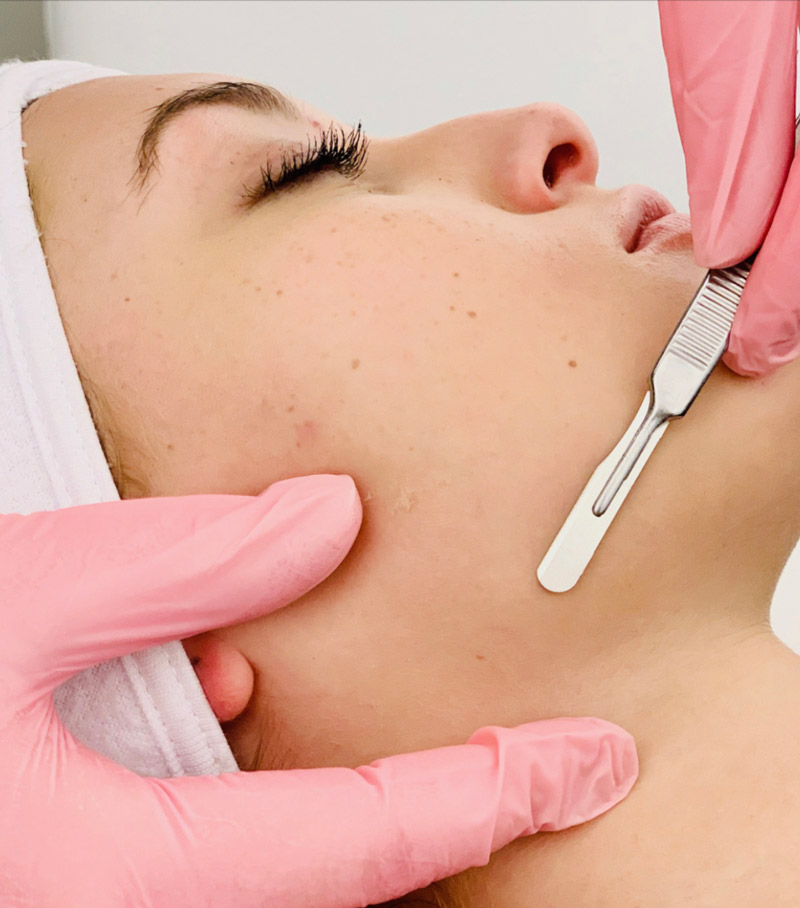 Dermaplaning for Smooth, Bright, Radiant Skin