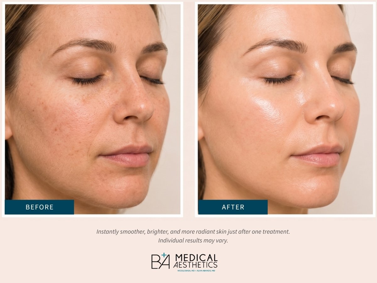 Instantly smoother, brighter, and more radiant skin just after one treatment.