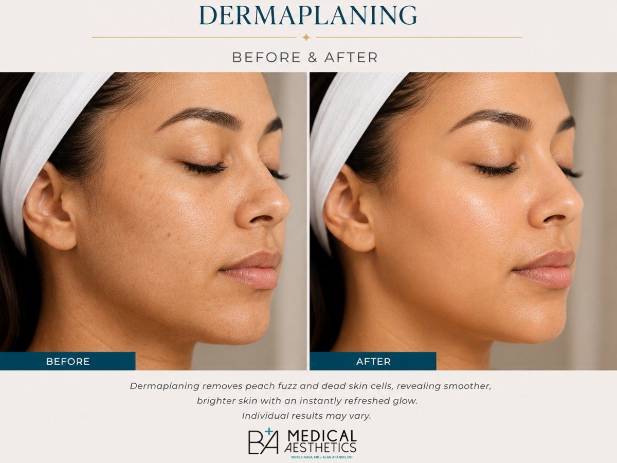 Before and after dermaplaning showing smoother skin texture and brighter complexion