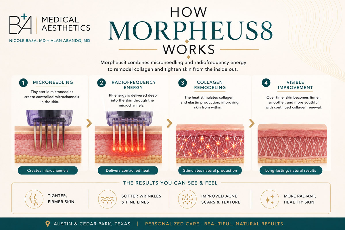 How Morpheus8 works — microneedling, radiofrequency energy, collagen remodeling — B+A Medical Center Cedar Park Austin TX
