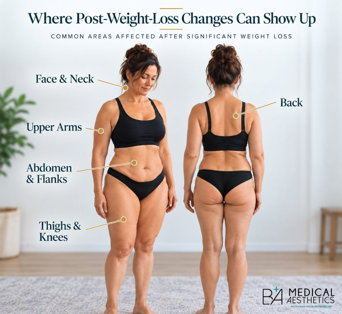 Where Post-Weight-Loss Changes Can Show Up — Face and Neck, Upper Arms, Abdomen and Flanks, Thighs and Knees, Back — B+A Medical Aesthetics Cedar Park Austin TX